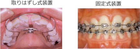 矯正装置