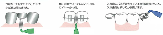 歯間ブラシの使い方