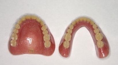 レジン床（プラスチック）の義歯
