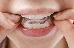 矯正なら豊田市の丸子歯科へ　新しい矯正装置の勉強会