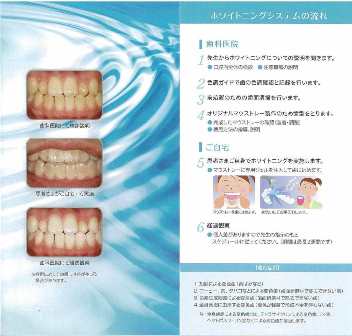 ホワイトニング ホワイトニング