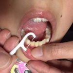 豊田市の丸子歯科　おすすめ糸ようじ／エクシブ琵琶湖