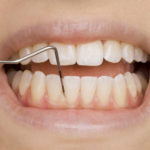 豊田市の丸子歯科　メインテナンス勉強会