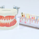 歯牙年齢チェック