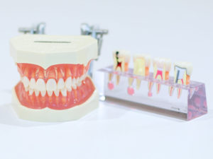 歯牙年齢チェック